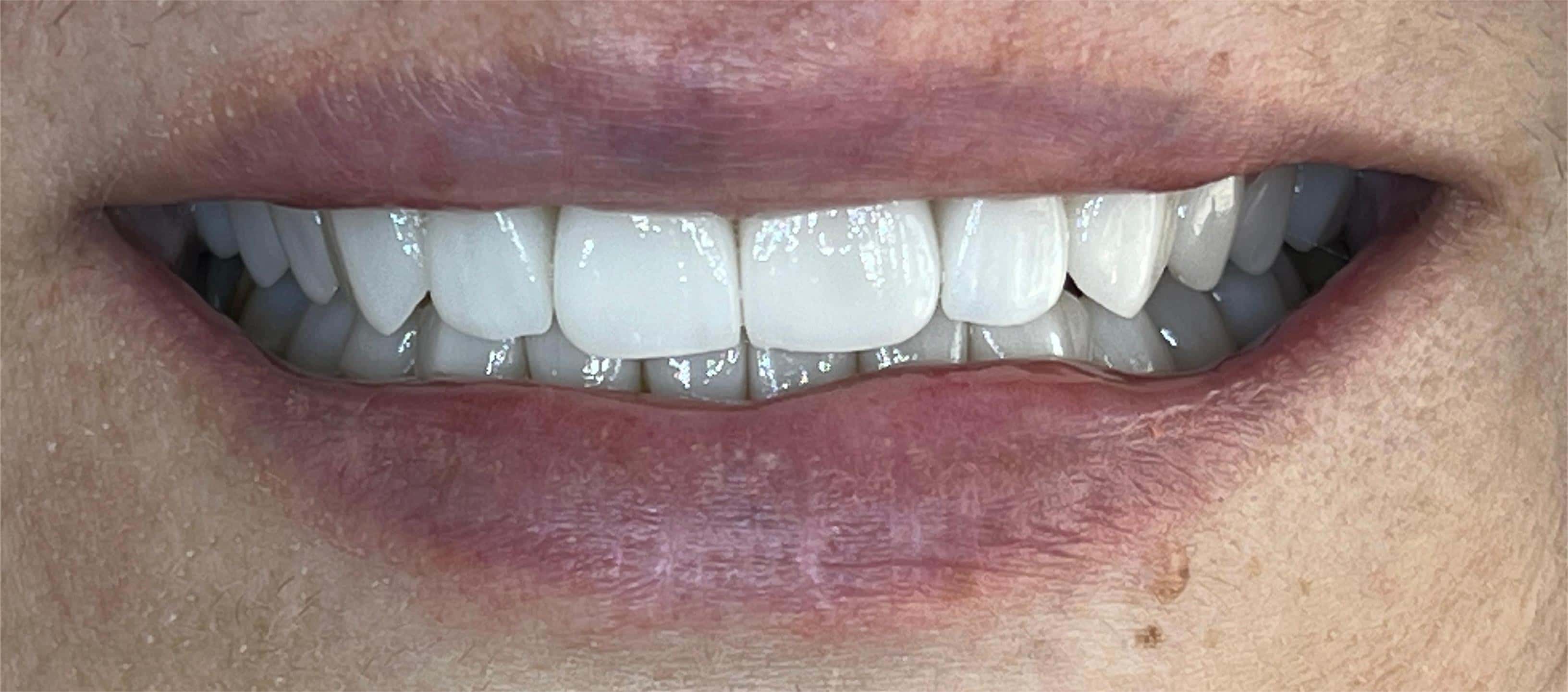 Dental transformation after treatment at Beyond Smiles Dental Clinic